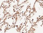 NBL1 Antibody in Immunohistochemistry (Paraffin) (IHC (P))