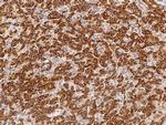 NDUFS3 Polyclonal Antibody