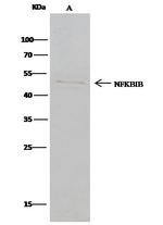 IkB beta Polyclonal Antibody