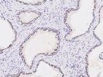 Nkx3.1 Polyclonal Antibody