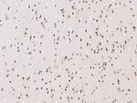 NR1D2 Antibody in Immunohistochemistry (Paraffin) (IHC (P))