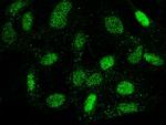 OLIG2 Antibody in Immunocytochemistry (ICC/IF)