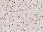 OLIG2 Antibody in Immunohistochemistry (Paraffin) (IHC (P))