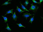 LOX-1 Antibody in Immunocytochemistry (ICC/IF)