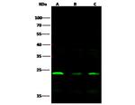 DJ-1 Antibody in Western Blot (WB)