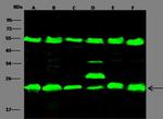 DJ-1 Antibody in Western Blot (WB)