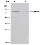 PHGDH Antibody in Immunoprecipitation (IP)
