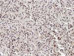 PHYH Polyclonal Antibody