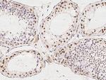 PIWIL4 Antibody in Immunohistochemistry (Paraffin) (IHC (P))