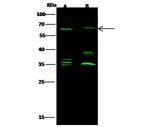 PLBD2 Antibody in Western Blot (WB)