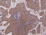LPPR4 Polyclonal Antibody