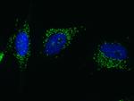 PML Polyclonal Antibody
