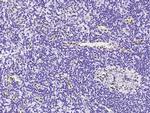 PML Antibody in Immunohistochemistry (Paraffin) (IHC (P))