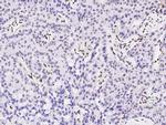 PML Antibody in Immunohistochemistry (Paraffin) (IHC (P))