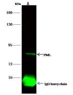 PML Antibody in Immunoprecipitation (IP)