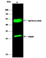 PMM2 Antibody in Immunoprecipitation (IP)
