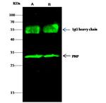 PNP Antibody in Immunoprecipitation (IP)