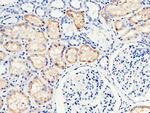 RBP4 Polyclonal Antibody