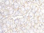 Periostin Antibody in Immunohistochemistry (Paraffin) (IHC (P))