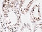PRDM9 Antibody in Immunohistochemistry (Paraffin) (IHC (P))
