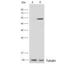 PRKAR1A Polyclonal Antibody