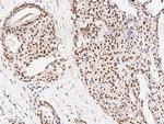 PRMT6 Antibody in Immunohistochemistry (Paraffin) (IHC (P))