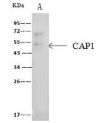 CAP1 Antibody in Immunoprecipitation (IP)