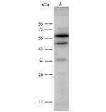 CAP1 Antibody in Western Blot (WB)