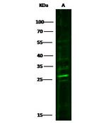 PRTFDC1 Polyclonal Antibody