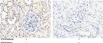PTH1R Polyclonal Antibody