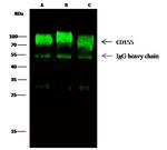 CD155 Antibody in Immunoprecipitation (IP)