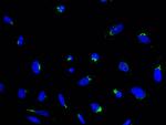 RAB6A Antibody in Immunocytochemistry (ICC/IF)