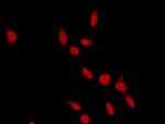 RAD18 Polyclonal Antibody