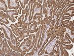 RhoBTB2 Antibody in Immunohistochemistry (Paraffin) (IHC (P))