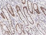 RNaseH2B Antibody in Immunohistochemistry (Paraffin) (IHC (P))