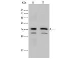 RNaseH2B Antibody in Western Blot (WB)