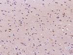 RNH1 Antibody in Immunohistochemistry (Paraffin) (IHC (P))