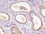 RNH1 Antibody in Immunohistochemistry (Paraffin) (IHC (P))