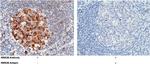 p53R2 Polyclonal Antibody
