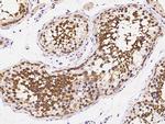 RUVBL1 Antibody in Immunohistochemistry (Paraffin) (IHC (P))