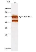 RUVBL1 Antibody in Immunoprecipitation (IP)