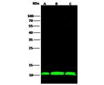S100A11 Polyclonal Antibody
