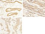 S100A6 Antibody in Immunohistochemistry (Paraffin) (IHC (P))