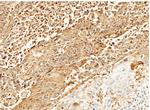S100A6 Antibody in Immunohistochemistry (Paraffin) (IHC (P))