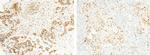 S100A6 Antibody in Immunohistochemistry (Paraffin) (IHC (P))