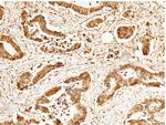 S100A6 Antibody in Immunohistochemistry (Paraffin) (IHC (P))