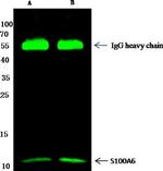 S100A6 Antibody in Immunoprecipitation (IP)