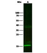 S100A7 Antibody in Western Blot (WB)