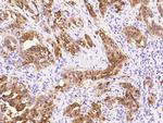 S100P Antibody in Immunohistochemistry (Paraffin) (IHC (P))
