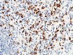 S100P Antibody in Immunohistochemistry (Paraffin) (IHC (P))